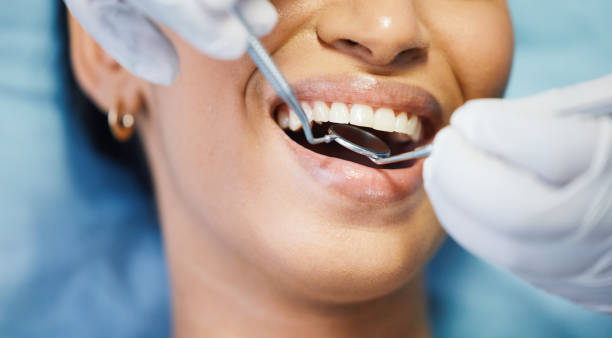 Best Emergency Treatment for Dental Infections or Abscesses in Berwick, LA