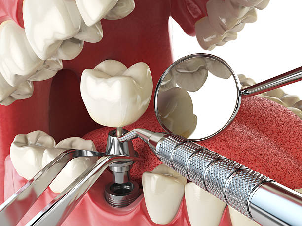 Best Pediatric Emergency Dentist in Berwick, LA